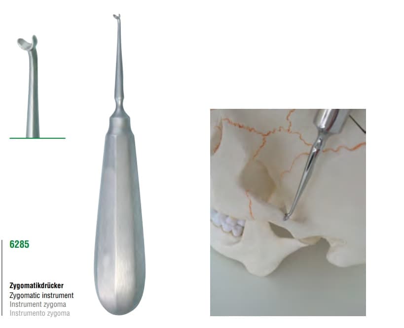 Zygomatic instrument — image 1